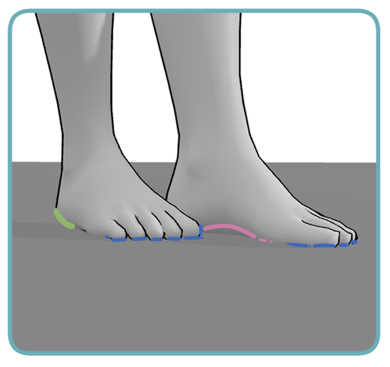 Heel, Arch And Toes When Foot Carries Weight|350