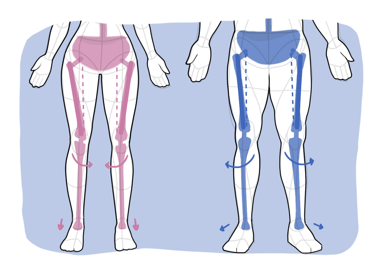 Female vs male leg anatomy showing femur angle and knee and ankle alignment differences